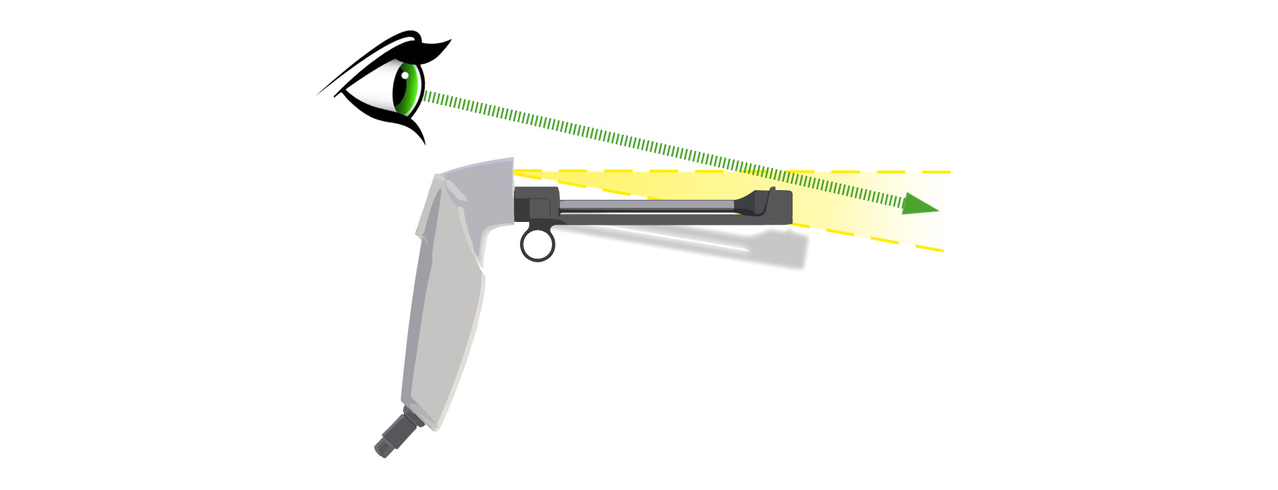 Showing the great visible accessibility of the Wisp C3 Thermocoagulator