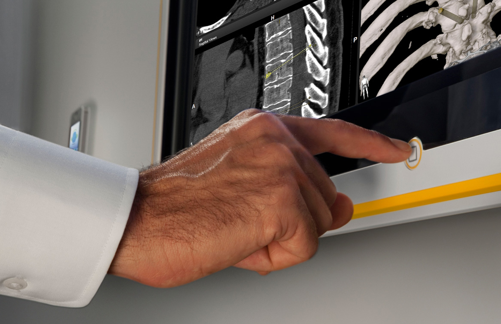 Finger pressing a button on the Brainlab Buzz OR Monitor