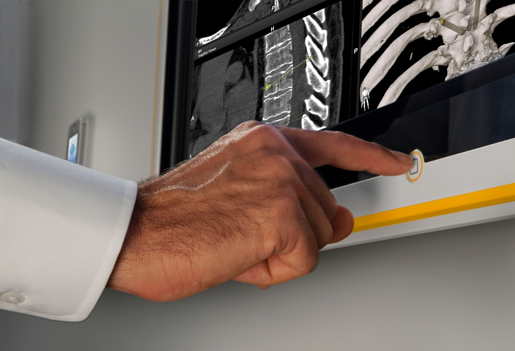 Finger pressing a button on the Brainlab Buzz OR Monitor