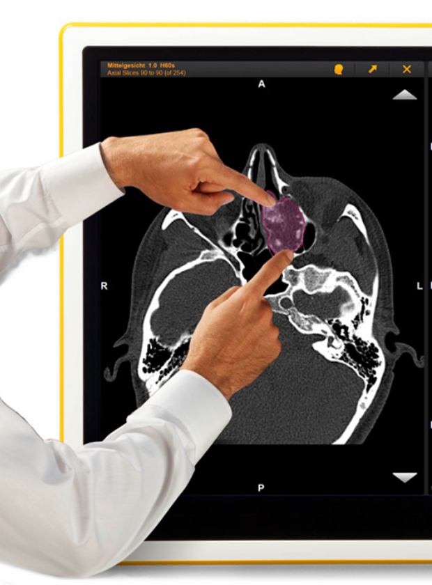 Two hands interacting with the Brainlab Buzz OR Monitor